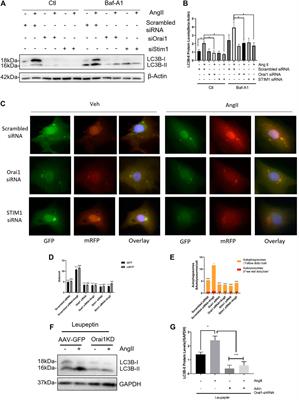 Ang II Promotes Cardiac Autophagy and Hypertrophy via Orai1/STIM1